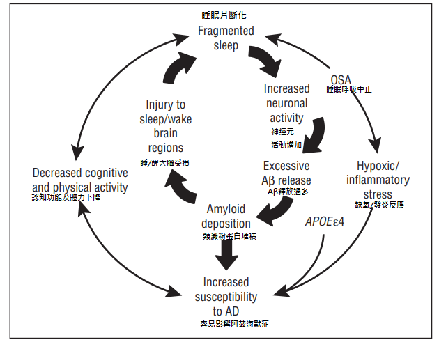 sleep and Alzheimer disease 