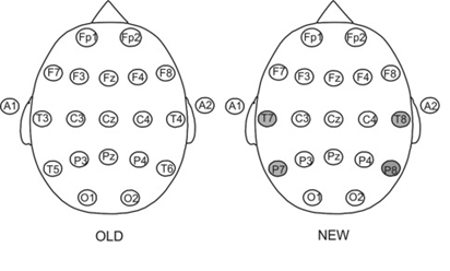 EEG-10-20 system